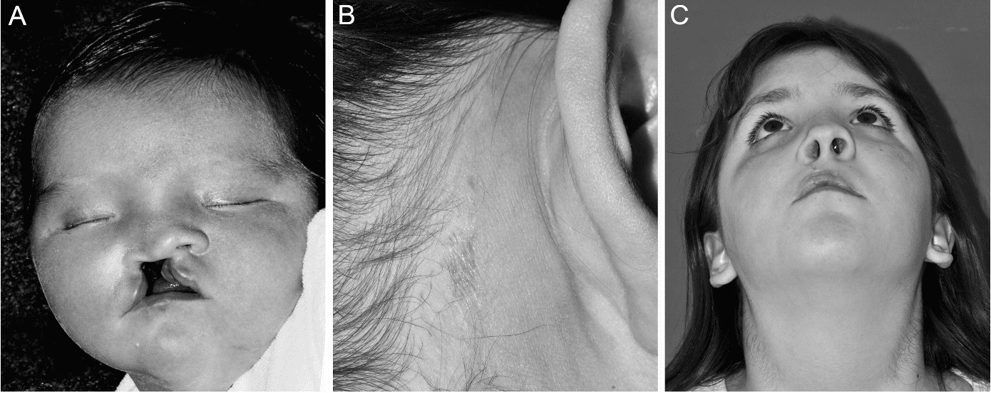 9 Rarest Birth Defects