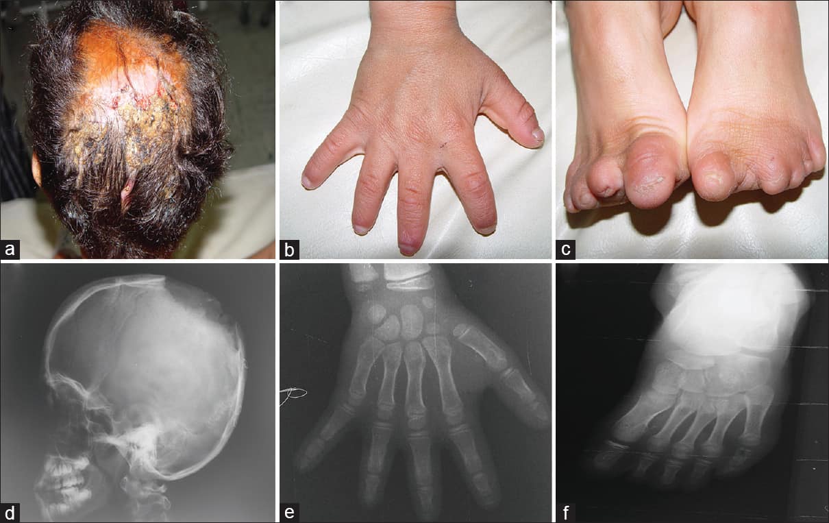 9 Rarest Birth Defects