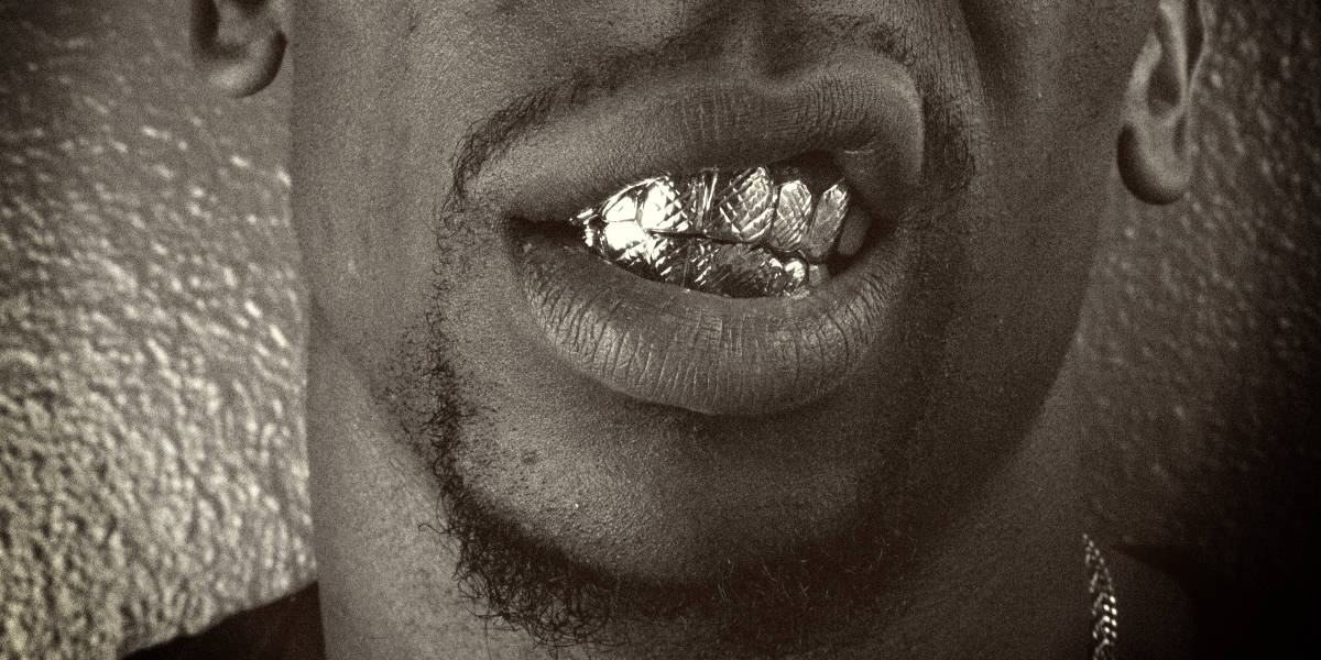 Most Expensive Teeth Grillz in the World
