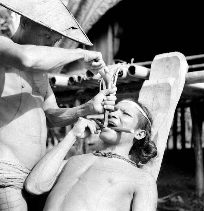 Teeth Chiseling in Mentawai, Indonesia