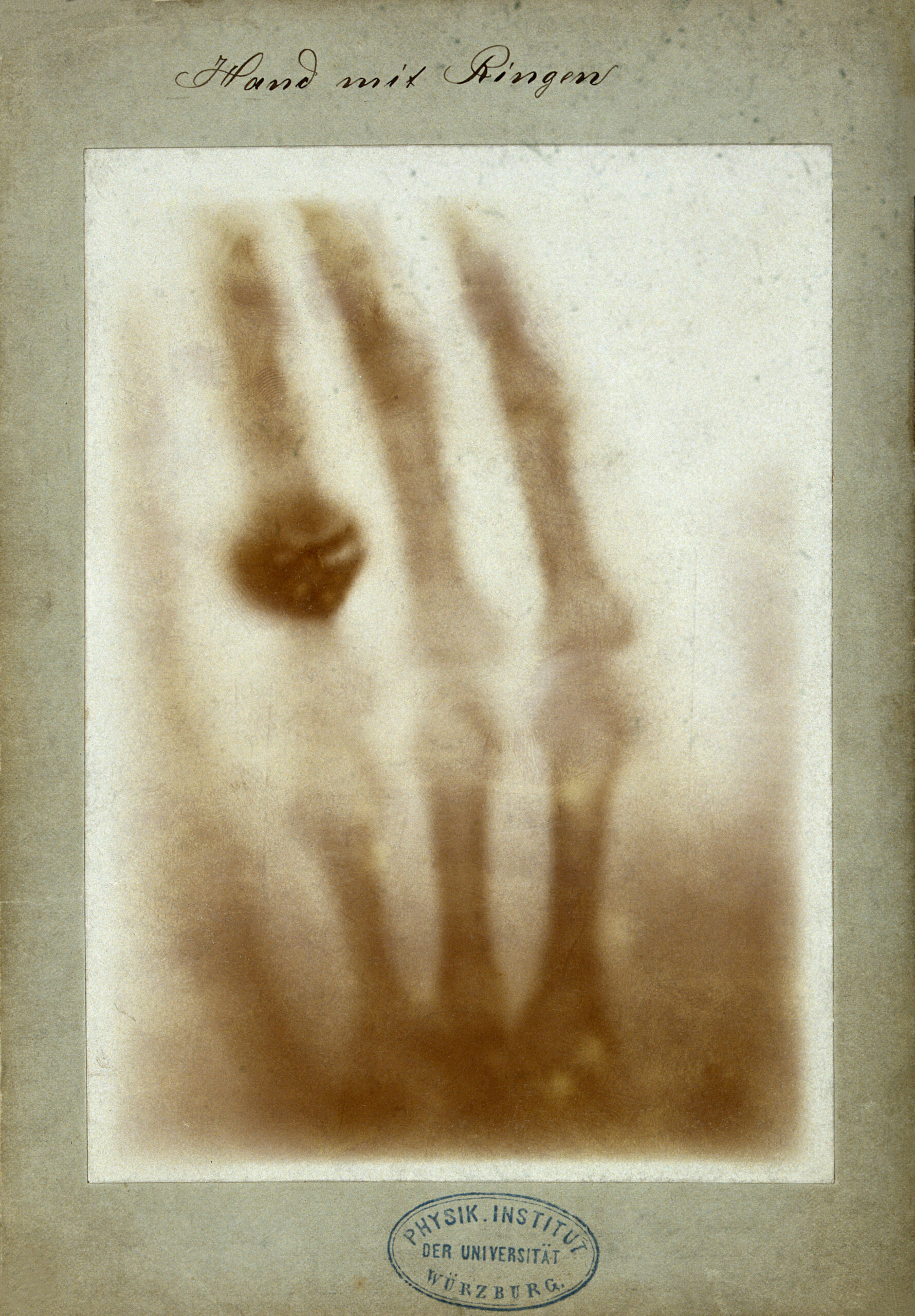 The First X-ray Image (1895)