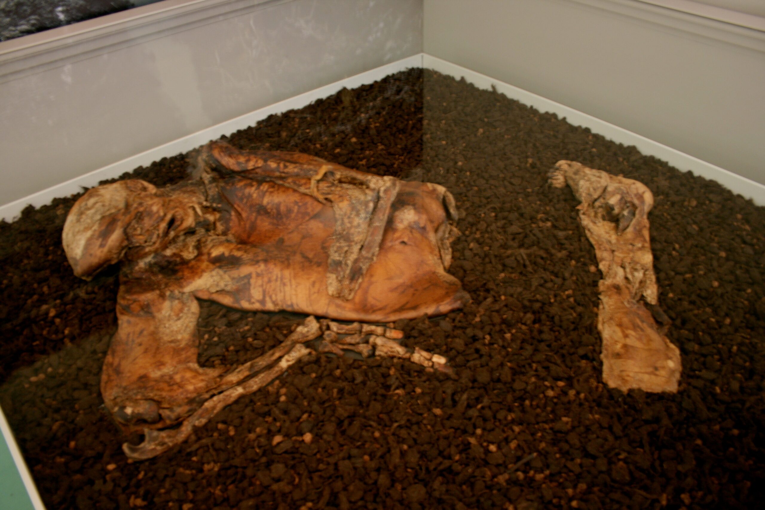 Lindow Man (United Kingdom)