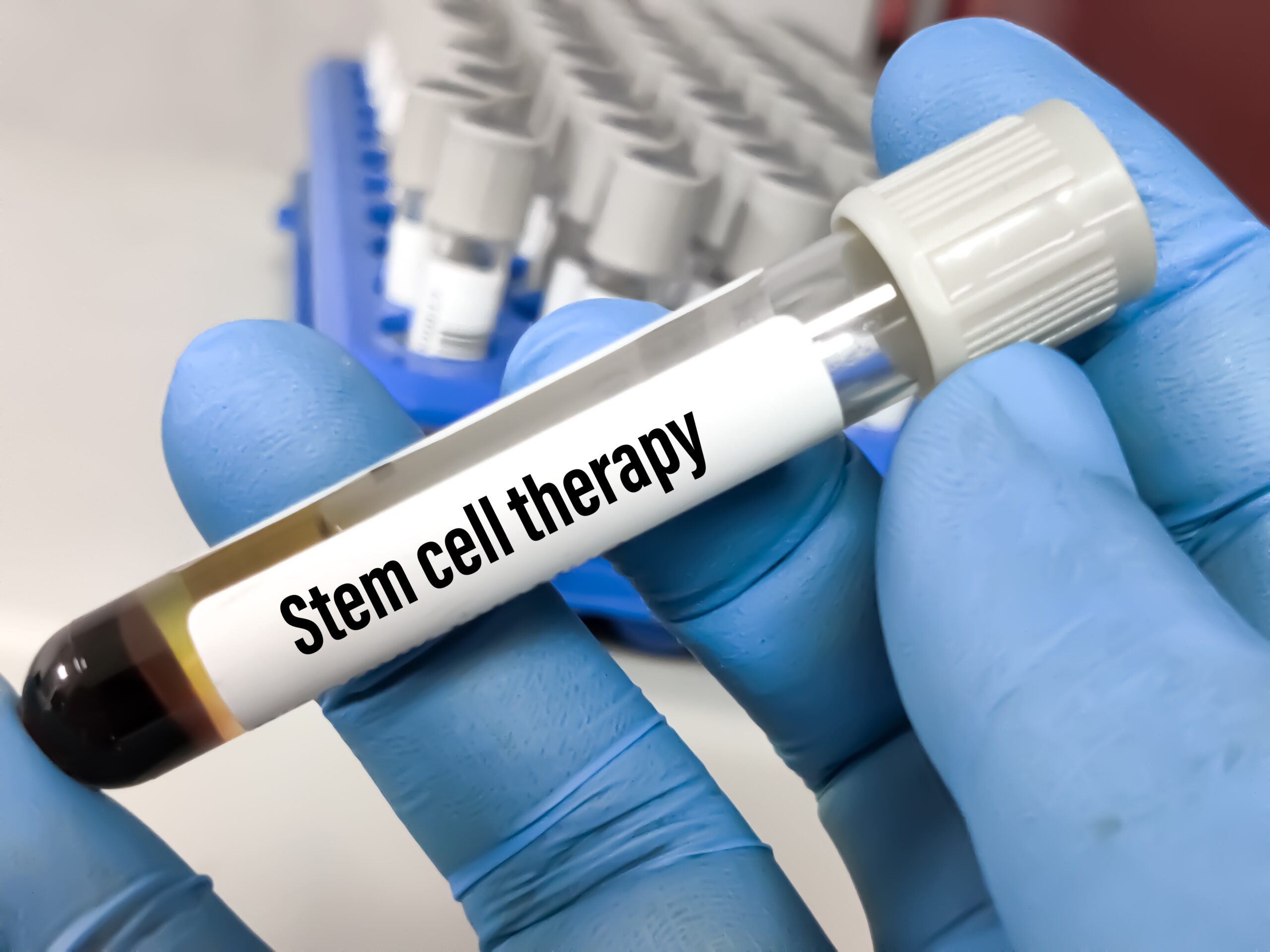 Stem Cell Therapy (1961)