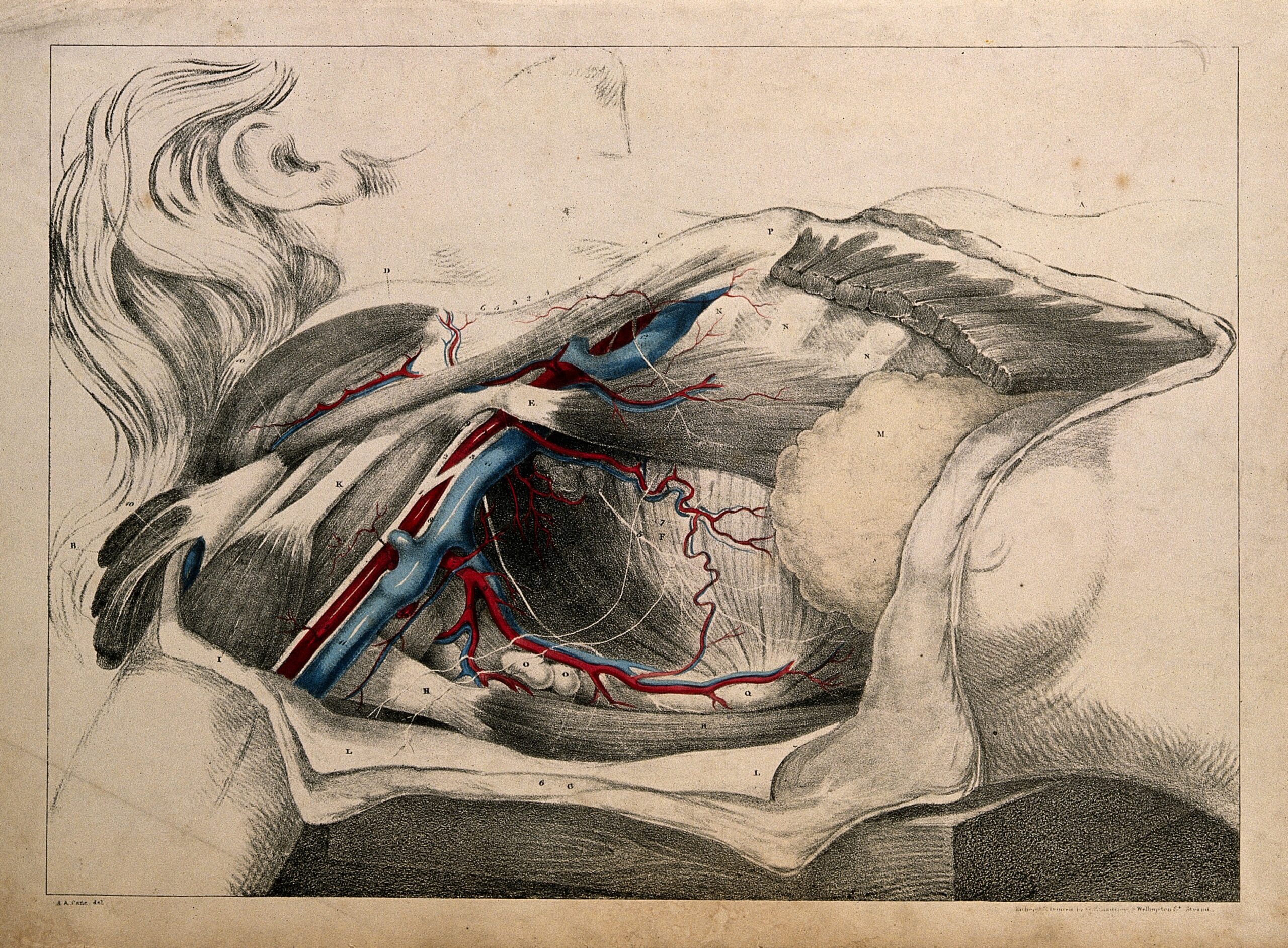 Subclavian Artery