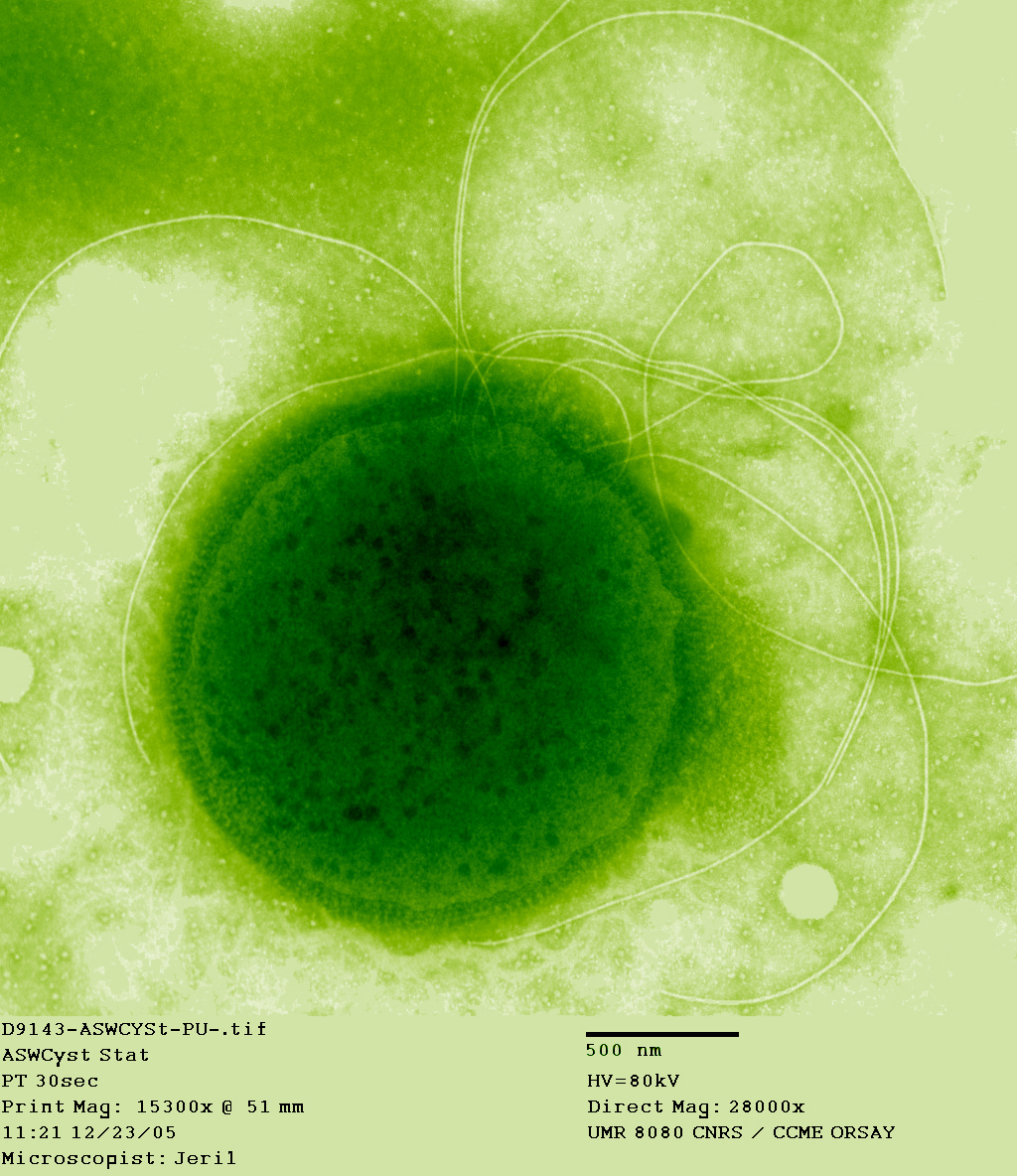 Thermococcus (Heat-Loving Microbes)