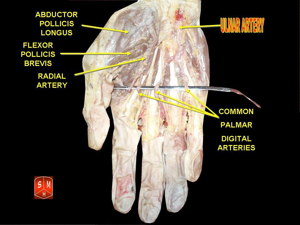 Ulnar Artery